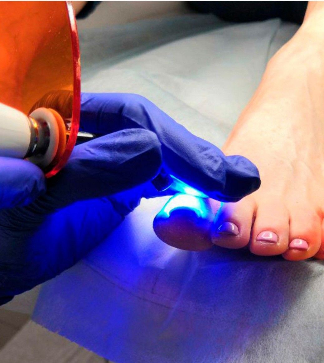 Pedicure Clínico en Santiago - Aura Stella Santiago Centro